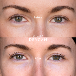 Red Carpet Ready – Dr. Lara Devgan Skincare