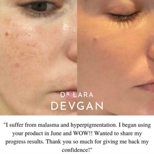 The Hyperpigmentation Collection – Dr. Lara Devgan Skincare