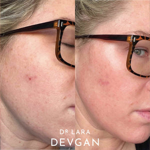 
                  
                    Load image into Gallery viewer, Dr. Lara Devgan x Casa Cipriani Firming Serum
                  
                