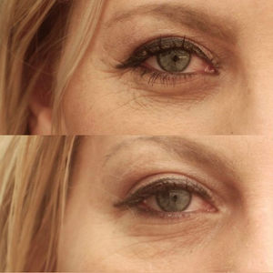 
                  
                    Load image into Gallery viewer, Before and after showing reduction of fine lines after using eye cream
                  
                